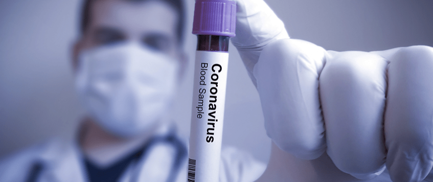 Como o Coronavírus pode impactar o seu negócio